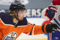 Edmonton Oilers' William Lagesson (84) is injured with a cut to his face during first-period NHL hockey game action against the Montreal Canadiens in Edmonton, Alberta, Monday, Jan. 18, 2021. (Jason Franson/The Canadian Press via AP)