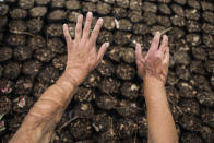 Elisa Xolalpa shows the burn marks on her hands and arms caused by an acid attack while tied to a post by her ex-partner 20 years ago when she was 18, during an interview at her greenhouse where she grows plants to sell at a market in Mexico City, Saturday, June 12, 2021. The acid dissolved the ropes, but also her clothes and her body as she ran half-naked for help. (AP Photo/Ginnette Riquelme)