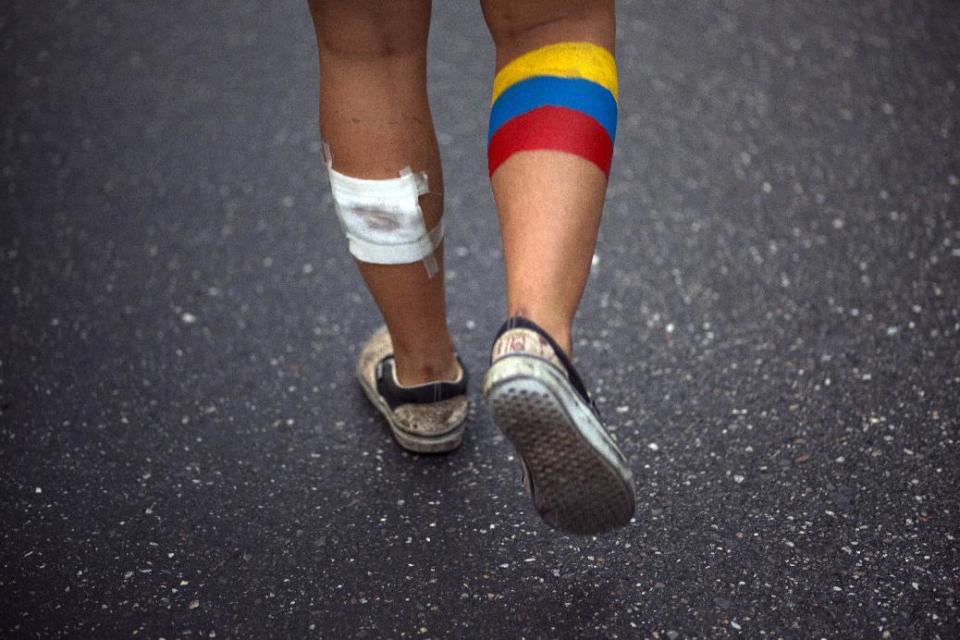 Un manifestante participa en una marcha contra el gobierno del presidente Nicolás Maduro para lo cual ha pintado su pierna derecha con los colores de la bandera venezolana, en Caracas, Venezuela, el miércoles 16 de abril de 2014. T(AP Photo/Ramon Espinosa)