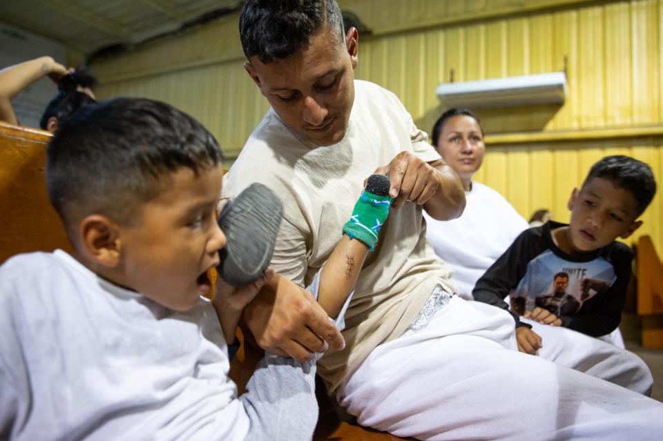 Omar Tortua, 27, from Venezuela, lifts his 5-year-old son Jesús’ pant leg to show a 2-inch laceration he sustained from razor wire crossing the Rio Grande, at Mission: Border Hope on Friday, July 21, 2023, in Maverick County, Texas.