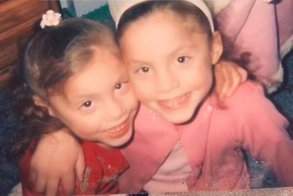 The former conjoined twins were the best of friends until both girls fell ill at 13 when mesh from the surgery that separated them became infected; Michaela became septic and died while Gabby survived (TikTok/oneleggabby)