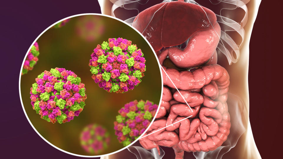 An illustration of the norovirus