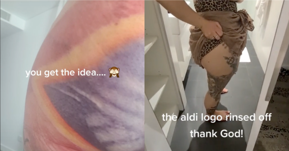 Aldi logo imprinted on woman's bottom; Woman showing logo washed off