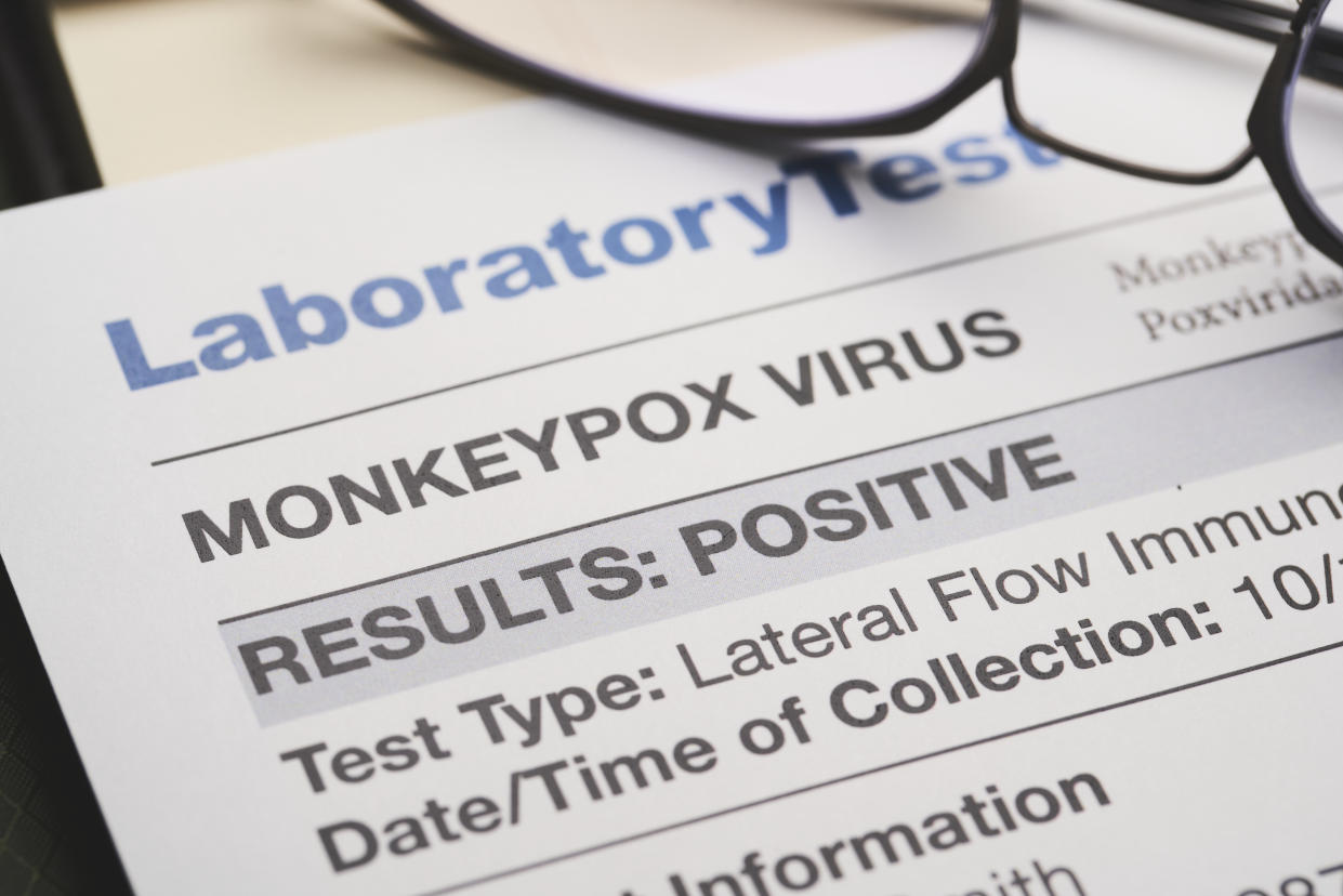 Monkeypox-virus-test