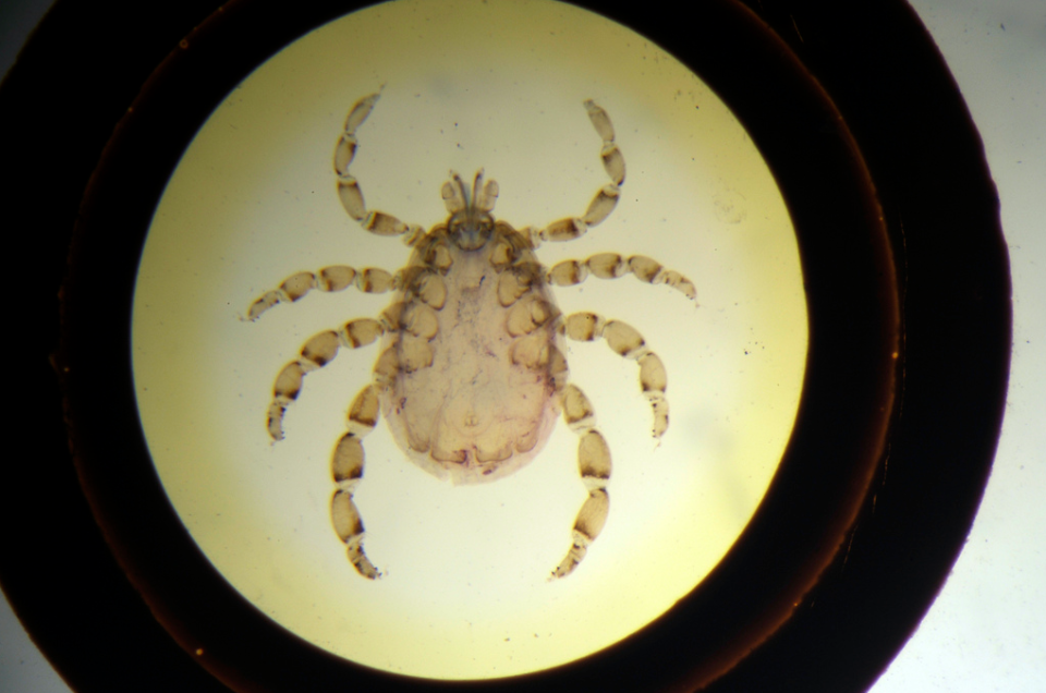 A slice through a tortoise mite. <a href="http://www.ucl.ac.uk/museums/zoology" rel="nofollow noopener" target="_blank" data-ylk="slk:(Courtesy of Richard Weedon, Grant Museum of ZoologyUCL;elm:context_link;itc:0;sec:content-canvas" class="link ">(Courtesy of Richard Weedon, Grant Museum of ZoologyUCL</a>