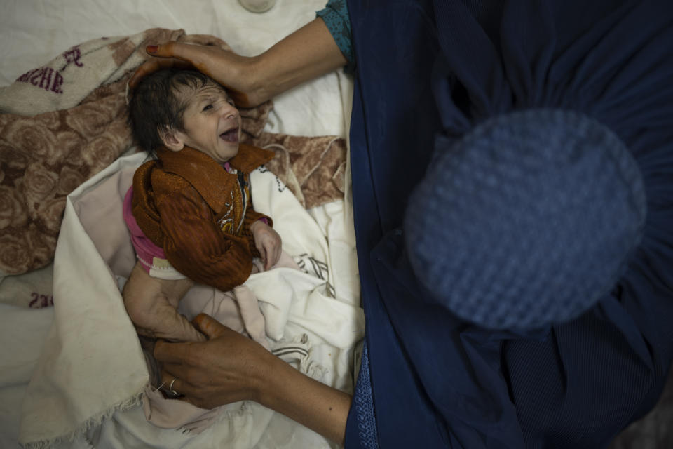 Sofia cradles her 2-month-old baby, Abdul, as he undergoes treatment at the malnutrition ward of the Indira Gandhi Children's Hospital in Kabul, Afghanistan, Tuesday, Oct. 5, 2021. Health workers in the hospital dashed back and forth caring for gasping premature newborns and others suffering from severe malnutrition and other diseases. (AP Photo/Felipe Dana)