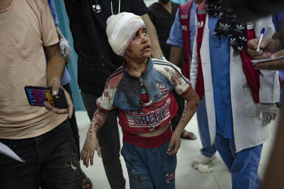 A Palestinian child, wounded in the Israeli bombardment of the Gaza Strip, is brought to a hospital in Khan Younis, Saturday, Oct. 21, 2023. (AP Photo/Fatima Shbair)