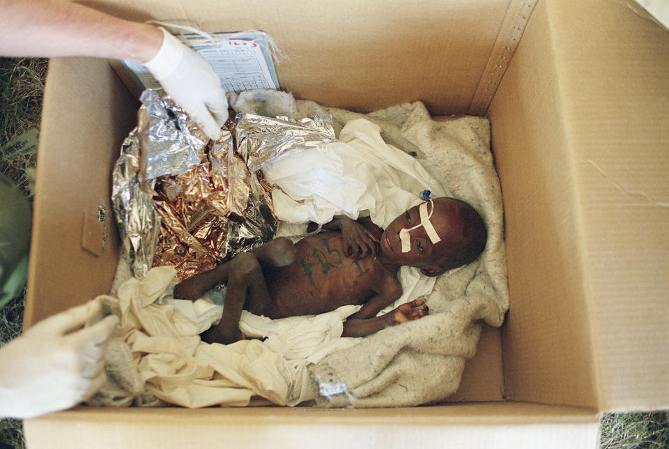 <p>A 6-month-old Rwandan baby girl weighing only 5 1/2 pounds is fed through her nose while she rests in a cardboard box while being attended to by an Israeli doctor at the Israel Defense Forces field hospital in Goma, Zaire (DNC), on July 29, 1994. (Photo: Jacqueline Larma/AP) </p>