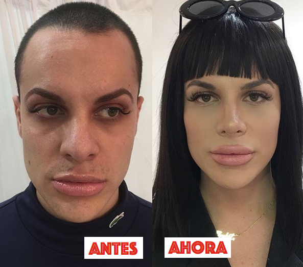 <p>Amante de la cirugía y de personajes como Kim Kardashian, Jedet cumplió su sueño de pasar por el quirófano a principios de año para someterse a una rinoplastia. “Siempre ha habido cosas que quería cambiar en mi cara, pero no me traumatizaban. Podía haber vivido toda la vida con mi nariz, no era algo que necesitaba, pero pude operarme y lo hice”, cuenta el catalán, que no siente ni hombre ni mujer. Además, Jedet suele rellenarse los labios periódicamente (Fotos: Instagram). </p>