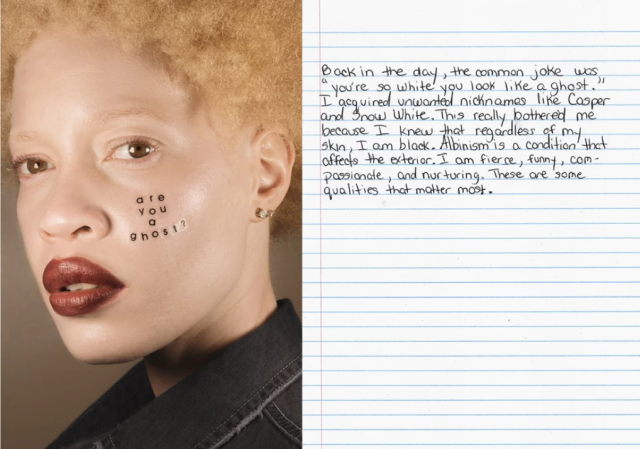 Portrait Series Highlights Beauty of Albinism, Birthmarks & Other Skin  Conditions