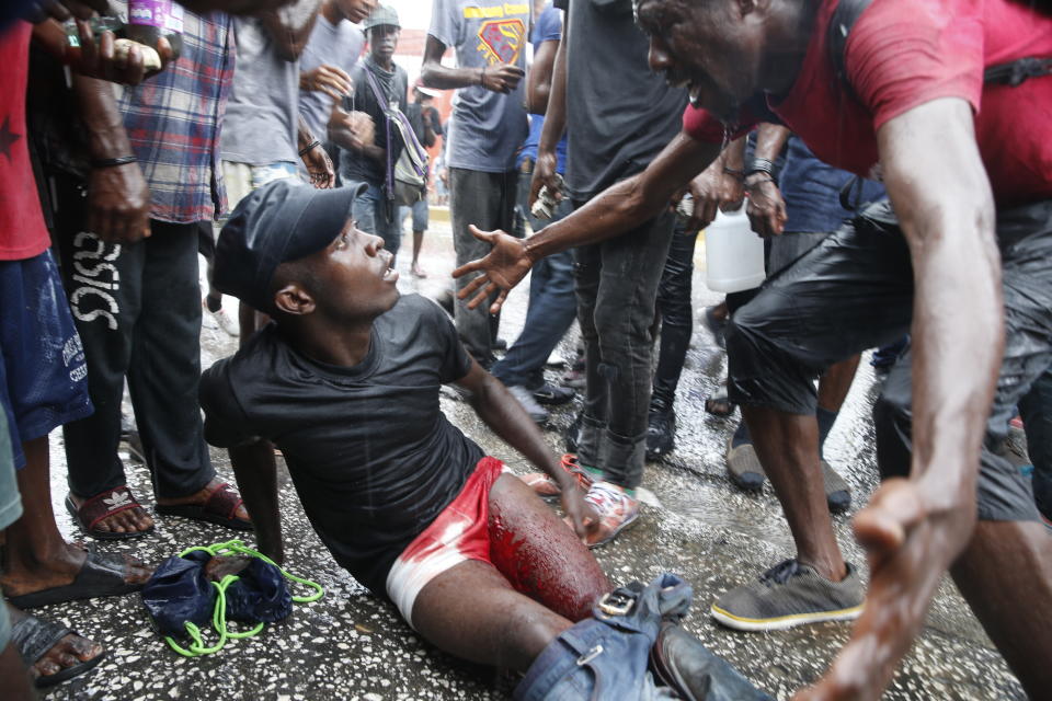 A protester cries out over an injured protester after police launched tear gas to disperse demonstrators who set fires and chanted calls for Haiti's president to resign, in Port-au-Prince, Haiti, Monday, Sept. 30, 2019. Opposition leaders and supporters say they are angry about public corruption, spiraling inflation and a dwindling supply of gasoline. (AP Photo/Rebecca Blackwell)