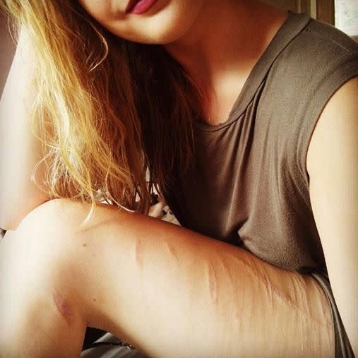 Becci admits she's undergone therapy to feel more comfortable with herself. Photo: Instagram/becciwain