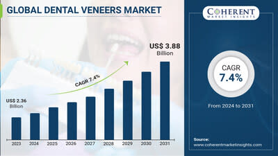 Buy dental veneers