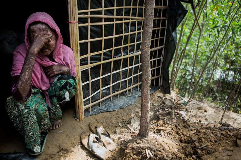 孟加拉境內的羅興亞難民營，一名皮膚病變的難民女子。（國際特赦組織）