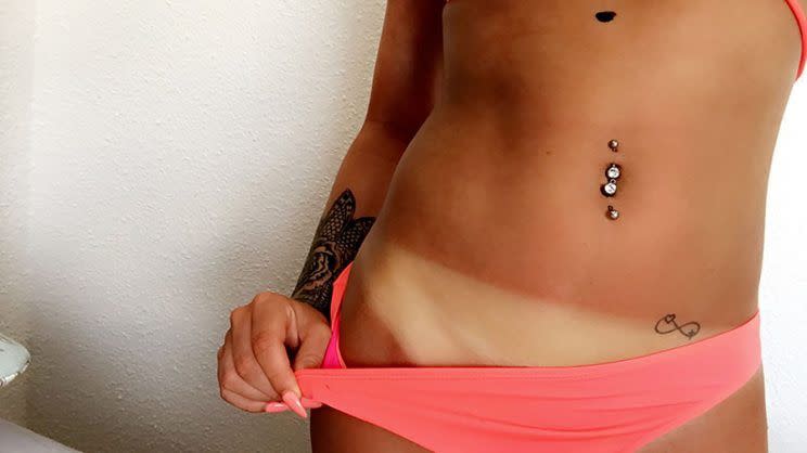 Cloe Jordan muestra sus marcas de bronceado y su lunar. (Foto: Caters Noticias)