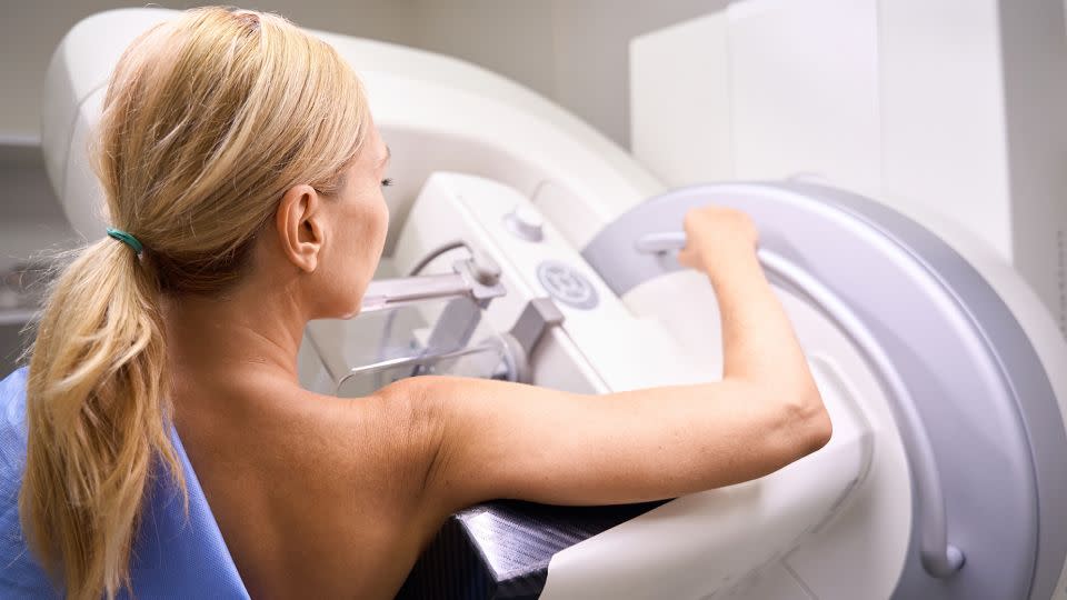 People should now starting getting mammograms at age 40, according to new recommendations. - yacobchuk/iStockphoto/Getty Images