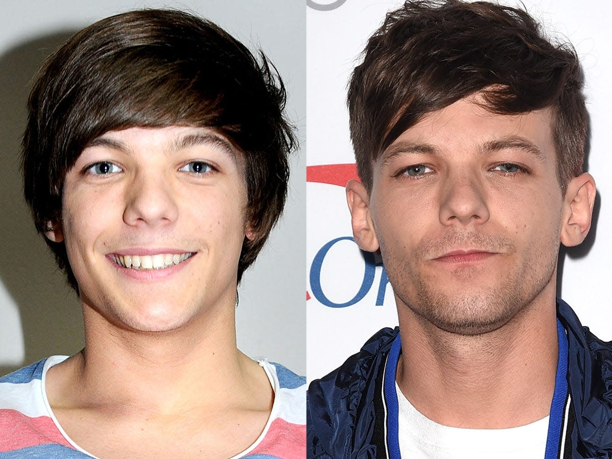 louis tomlinson then and now