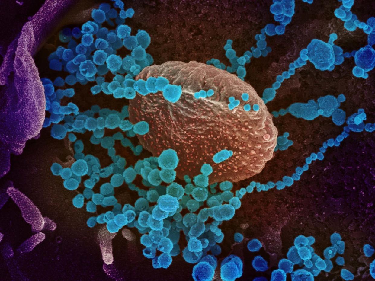 An image showing the virus (round blue objects) that causes COVID-19 under a scanning electron microscope: EPA