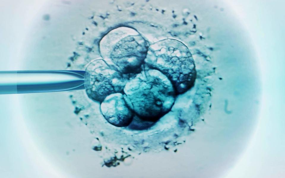 IVF - Science Photo Library - ZEPHYR  /Brand X  