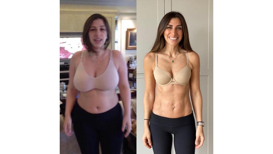 side by side photo of a woman before and after weight loss