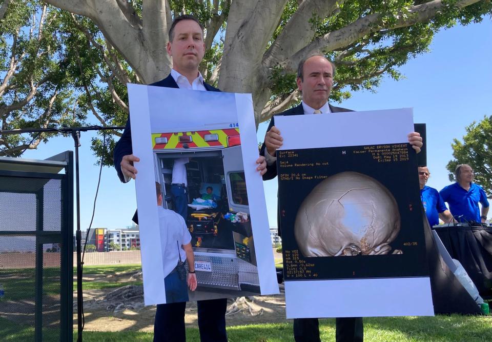Attorney Keith Bruno, left, and Kyle Scott hold up a photo of Bryson Galaz and imaging of his skull during a news conference. The mother of Bryson Galaz, who was accidentally hit in the head with a baseball, is suing the Los Angeles Angels.