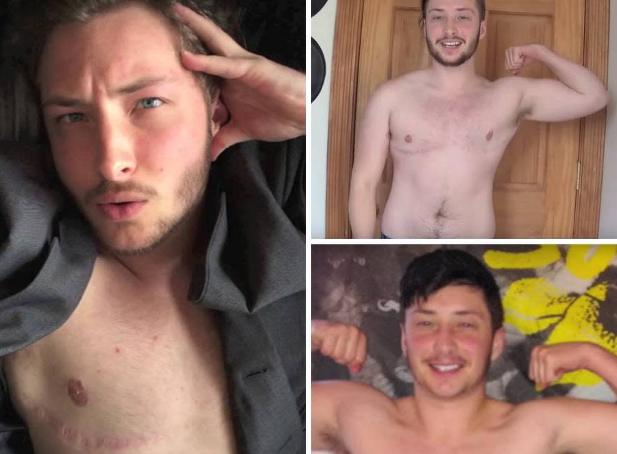 There's a Reason This Trans Man and Former Beauty Queen Wants to Show You His Scars 