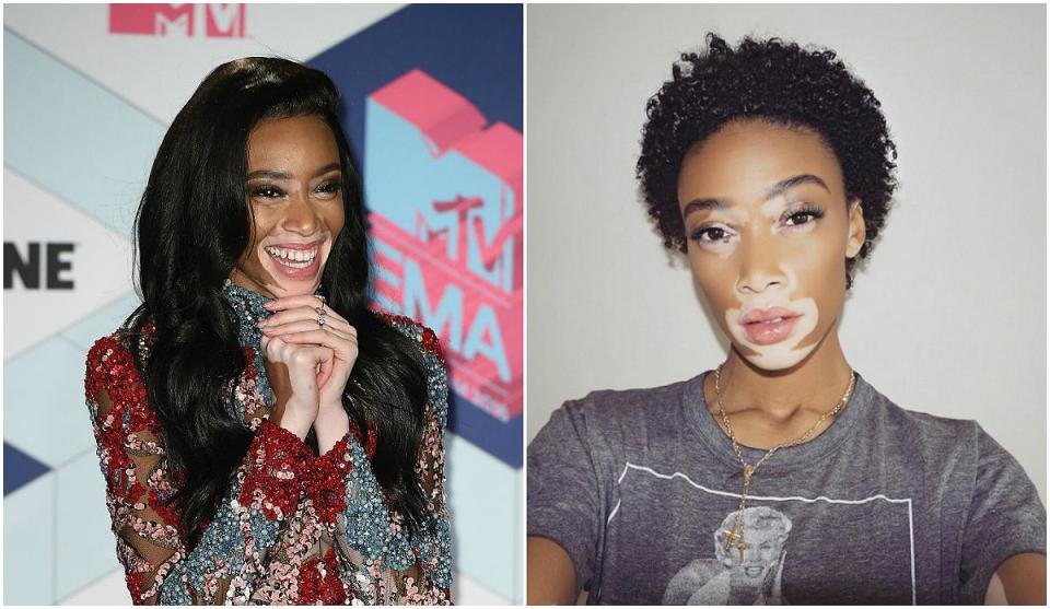 <p>Le mannequin Winnie Harlow a coupé ses longs cheveux afin d’opter pour une coupe courte naturellement bouclée. Elle a présenté sa nouvelle coupe chic en novembre sur Instagram. <em>(Photos : Instagram/November 2016)</em> </p>