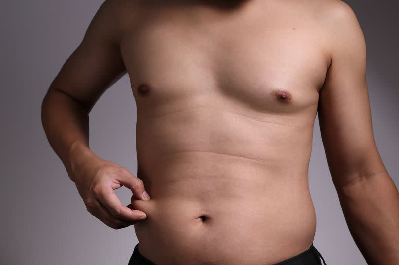 Man pinching his belly fat