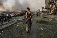 FILE - In this Aug. 4, 2020 file photo, Hoda Kinno, 11, is evacuated by her uncle Mustafa, in the aftermath of a massive explosion at the port in Beirut, Lebanon. The Kinno family from Syria's Aleppo region was devastated in the wake of the explosion -- Hoda suffered a broken neck and other injuries and her sister Sedra, 15, died in the explosion. (AP Photo/Hassan Ammar, File)