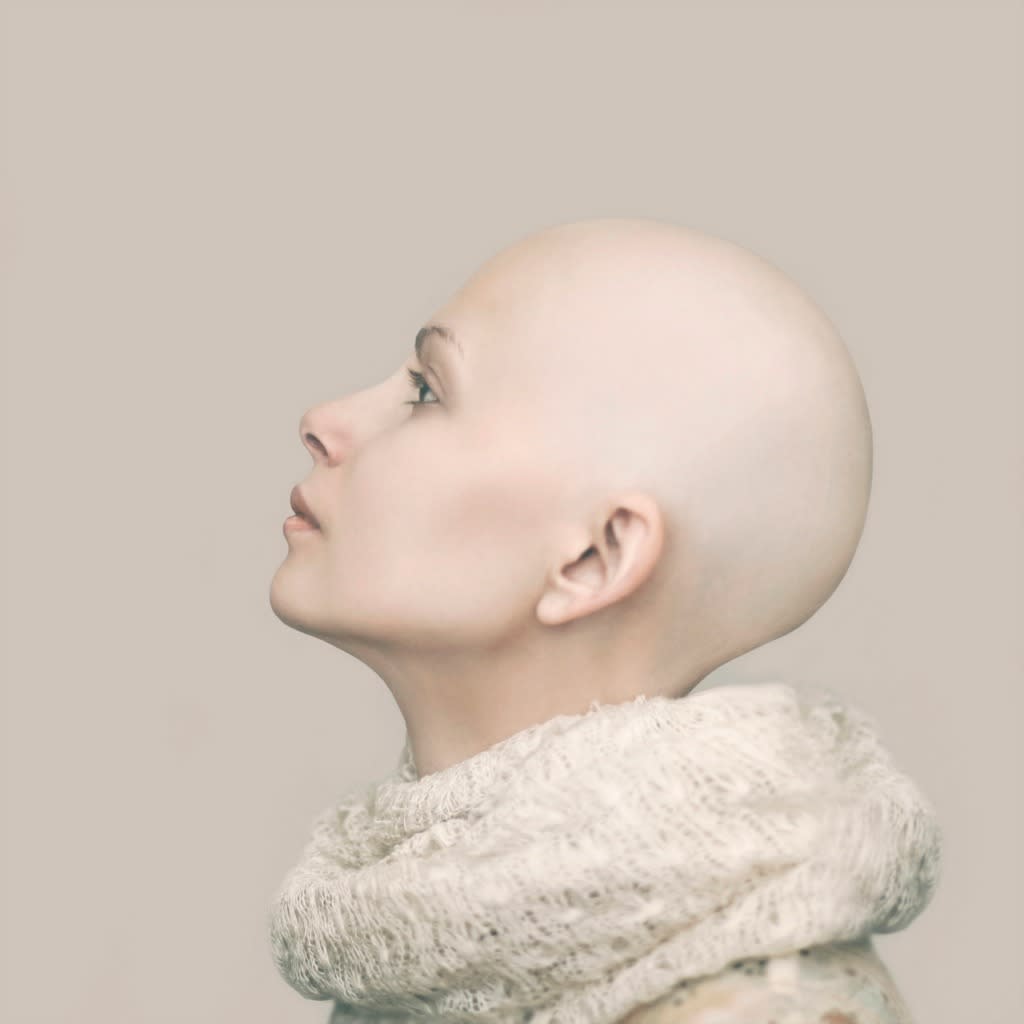 This empowering social media campaign is letting women prove that bald is beautiful. (Photo: Getty)