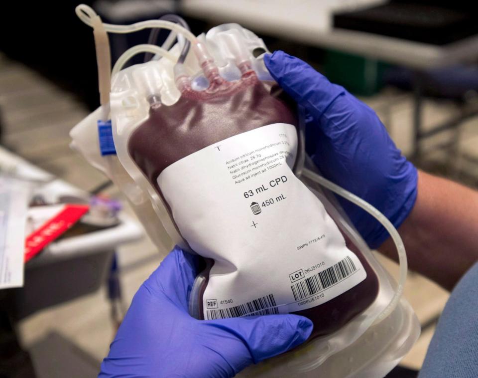 In 2021 Canadian Blood Services recommended an end to the ban on sexually active gay men donating blood in a submission to Health Canada.   (Ryan Remiorz/The Canadian Press - image credit)