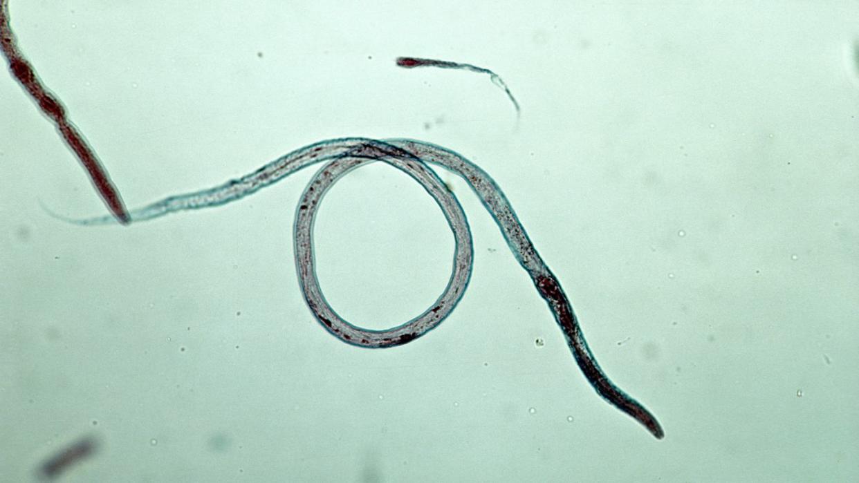 nematode vinegar eel turbatrix aceti phylum aschelminthes 50x