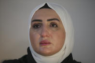 Fatima Alzahra Shon, 32, a Syrian refugee cries during an interview with The Associated Press in Istanbul, Friday, Sept. 17, 2021. Fatima Alzahra Shon thinks neighbors attacked her and her son in their Istanbul apartment building because she is Syrian. The 32-year-old refugee from Aleppo was confronted on Sept. 1 by a Turkish woman who asked her what she was doing in "our" country. Shon replied, "Who are you to say that to me?" The situation quickly escalated.(AP Photo/Emrah Gurel)