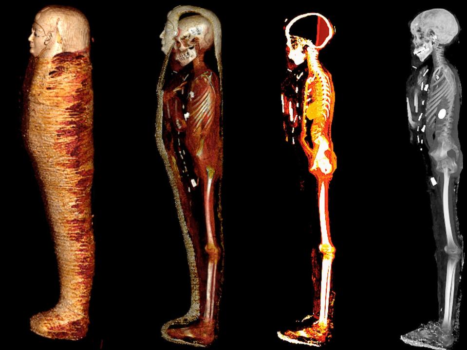 A side view of the mummy is shown at four different depths, the first with just the bandages, then the cartonnage with the body, then inside the body, then just the skeleton.