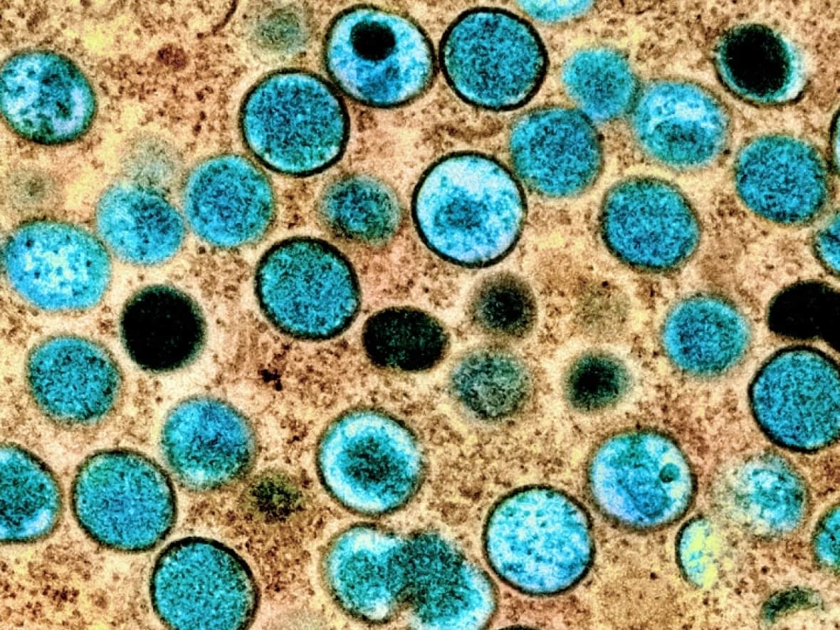 A colourized transmission electron micrograph of monkeypox particles (teal) found within an infected cell (brown), is shown in a handout photo captured at the National Institute of Allergy and Infectious Diseases Integrated Research Facility in Fort Detrick, Maryland. The Windsor-Essex health unit is holding a vaccine clinic for the disease Sunday.  (National Institute of Allergy and Infectious Diseases - image credit)