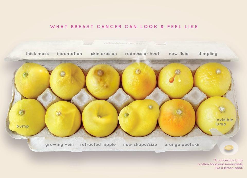 This Viral Photo of Lemons Can Help You Learn to Identify Signs of Breast Cancer