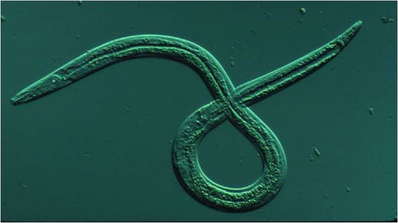 Una de las miles de especies de nematodos | imagen CAIB, Universidad de Vermont