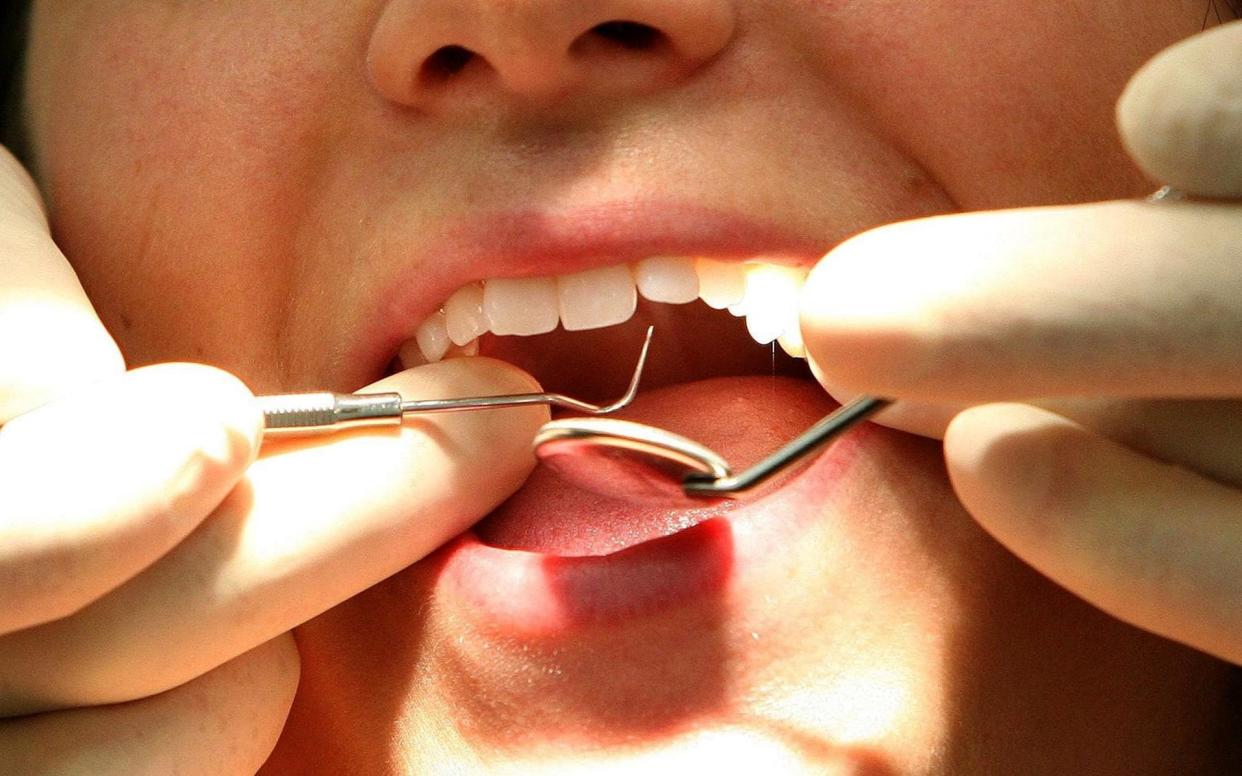 Good oral health may protect against Alzheimer's disease, a new study suggests  - PA