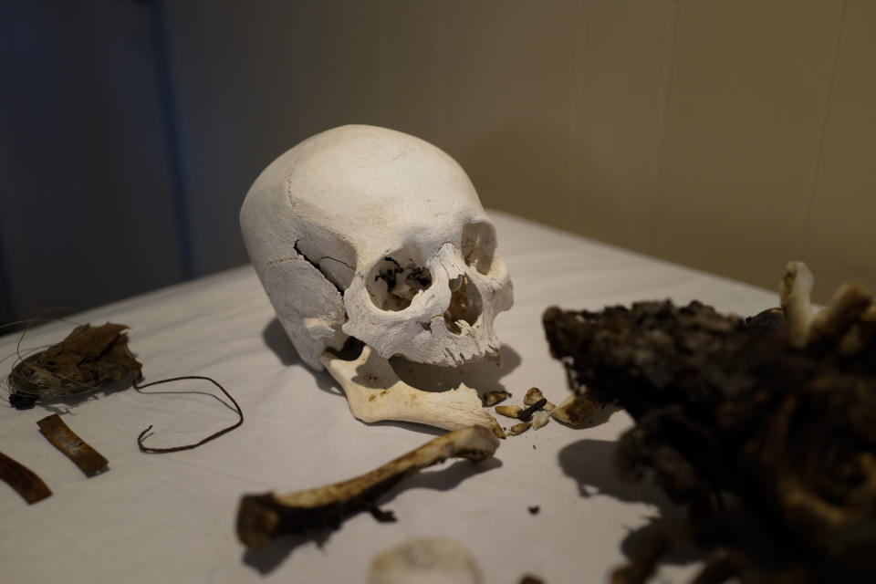 The skull of Giichi Matsumura is seen at Brune Mortuary in Bishop, Calif., Monday, Feb. 17, 2020. Giichi Matsumura was a prisoner at the Manzanar internment camp during World War II and died on a hike in the nearby Sierra in the waning days of the war in August 1945. Hikers discovered his mountainside grave and unearthed the skeleton in 2019, leading authorities to retrieve the bones and return them to the Matsumura family. (AP Photo/Brian Melley)