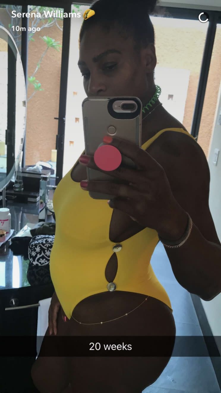 Serena Williams ist schwanger