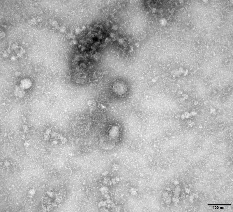 A Transmission Electron Microscopy image of the first isolated case of the coronavirus