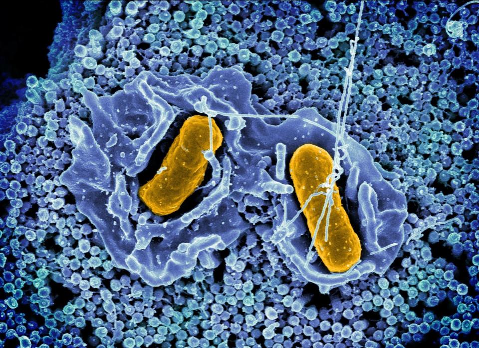 It takes a little more than a stomp to kill bacteria like <em>Salmonella</em>. <a href="https://flic.kr/p/2mbGDKv" rel="nofollow noopener" target="_blank" data-ylk="slk:NIAID/Flickr;elm:context_link;itc:0;sec:content-canvas" class="link ">NIAID/Flickr</a>, <a href="http://creativecommons.org/licenses/by/4.0/" rel="nofollow noopener" target="_blank" data-ylk="slk:CC BY;elm:context_link;itc:0;sec:content-canvas" class="link ">CC BY</a>