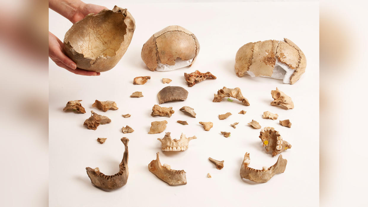  Human remains of mostly skull and jaw bone fragments are arranged as specimen samples on a white backdrop. . 