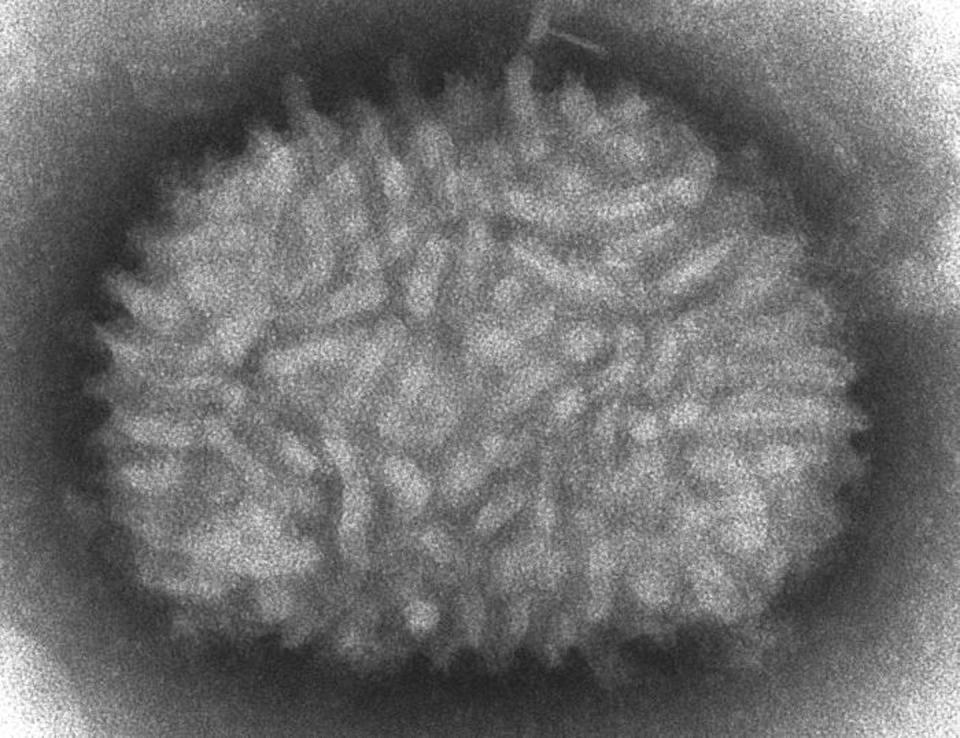 Both the Jynneos and ACAM2000 vaccines use the vaccinia virus, shown here, to produce immunity to smallpox and monkeypox. <a href="https://phil.cdc.gov/details.aspx?pid=2143" rel="nofollow noopener" target="_blank" data-ylk="slk:CDC/ Cynthia Goldsmith;elm:context_link;itc:0;sec:content-canvas" class="link ">CDC/ Cynthia Goldsmith</a>