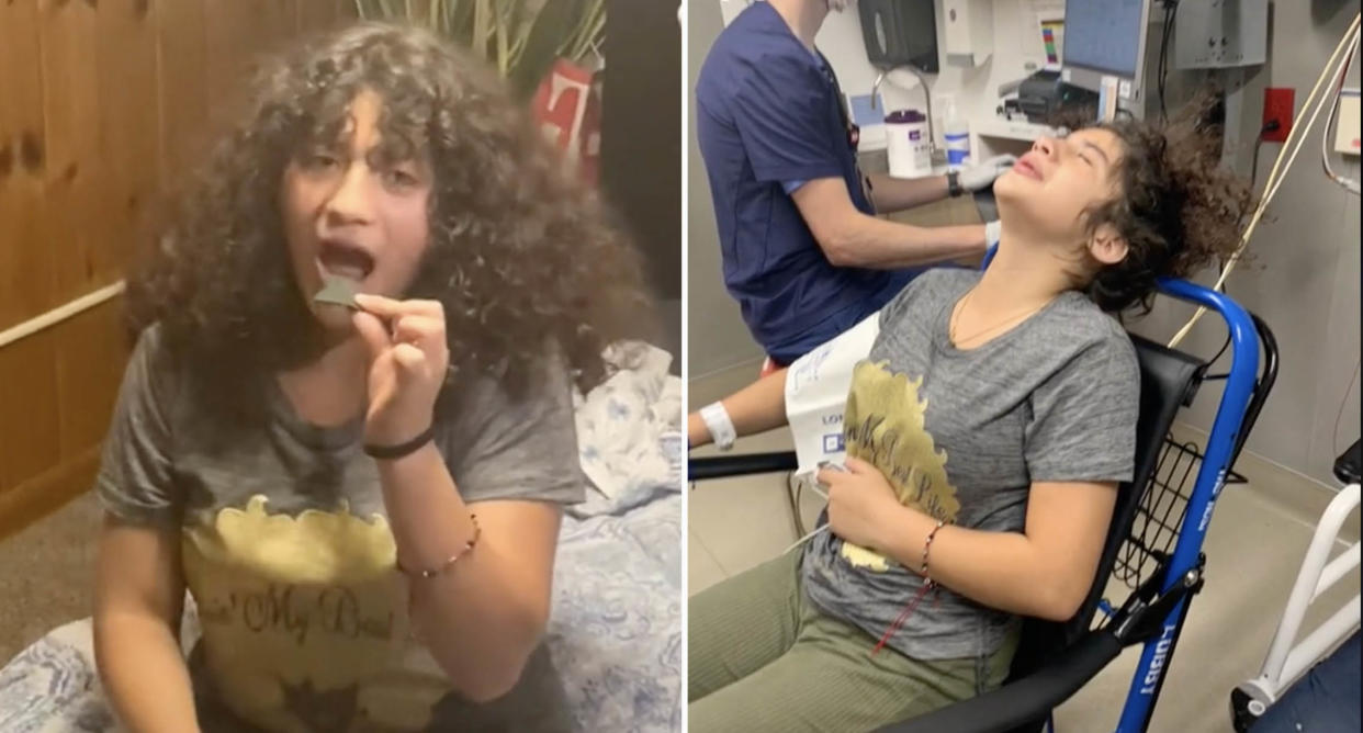 A TikTokers niece ended up in hospital after taking part in the One Chip Challenge. Source: TikTok