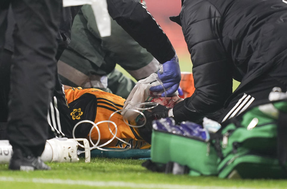 Wolverhampton Wanderers' Raul Jimenez receives treatment from medical staff following a head clash with Arsenal's David Luiz during the English Premier League soccer match between Arsenal and Wolverhampton Wanderers at Emirates Stadium, London, Sunday, Nov. 29, 2020. (John Walton/Pool via AP)