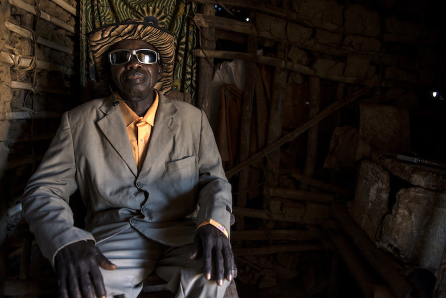 Bafimbo Baudoin, who has elephantiasis, still dresses to impress. (Photo: Neil Brandvold/DNDi)