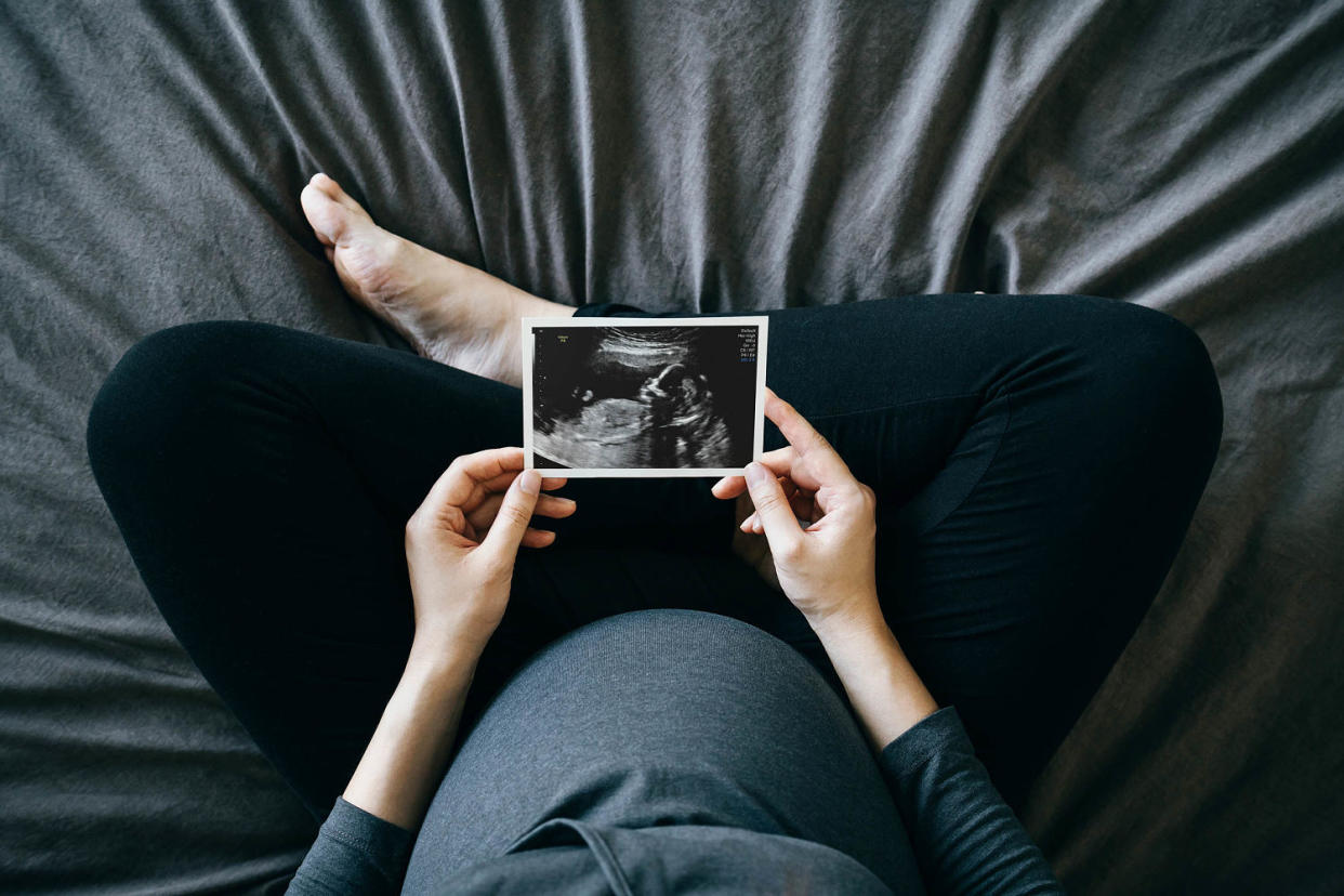 Pregnancy announcements (d3sign / Getty Images)