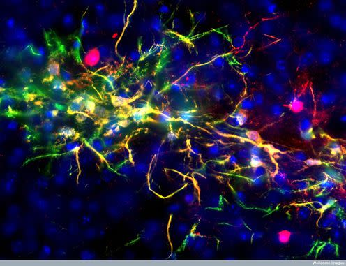 <span class="caption">Neural stem cells that have been transplanted into a mouse brain, here developing into neurons. </span> <span class="attribution"><span class="source">Yirui Sun, Wellcome Images</span>, <a class="link " href="http://creativecommons.org/licenses/by-sa/4.0/" rel="nofollow noopener" target="_blank" data-ylk="slk:CC BY-SA;elm:context_link;itc:0;sec:content-canvas">CC BY-SA</a></span>