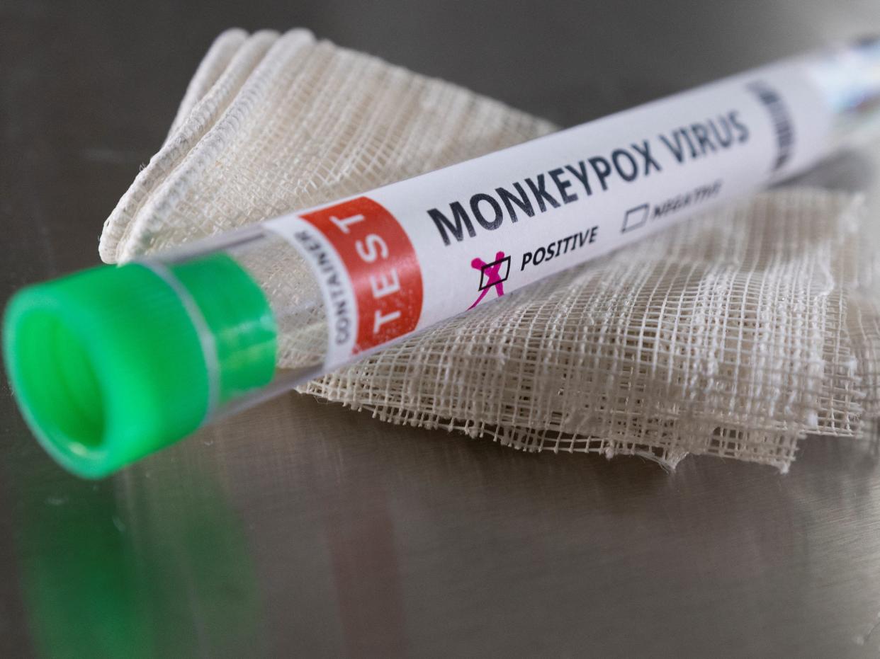 A test tube of a postive monkeypox virus sample.